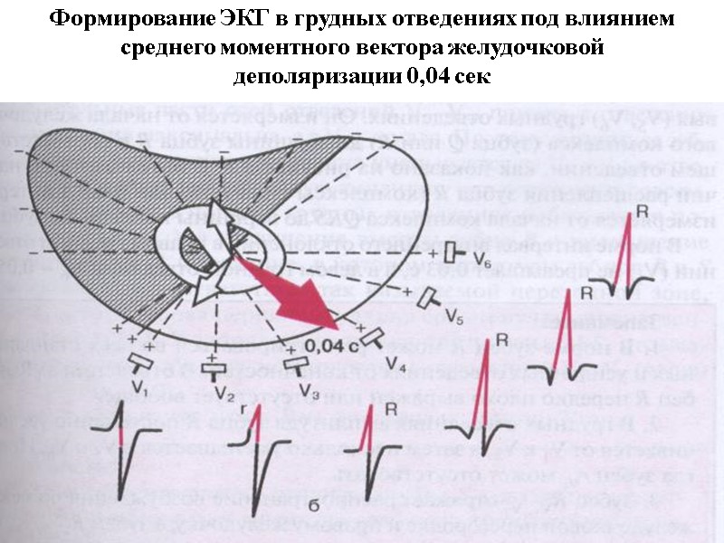Формирование ЭКГ в грудных отведениях под влиянием среднего моментного вектора желудочковой деполяризации 0,04 сек